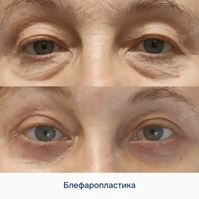 Результат работы 1