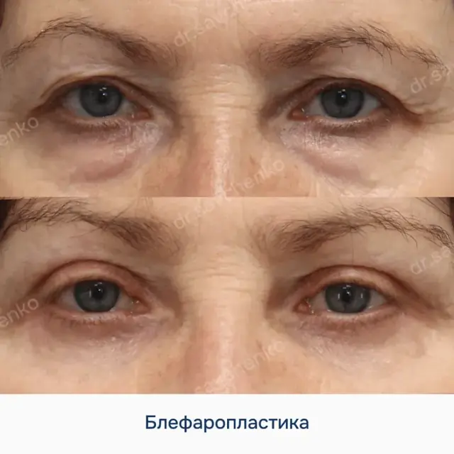Результат работы 2