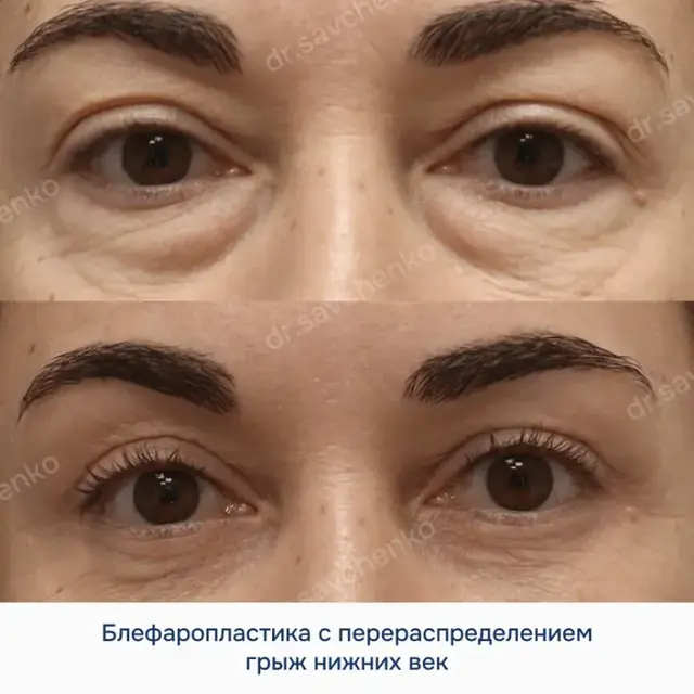 Результат работы 5